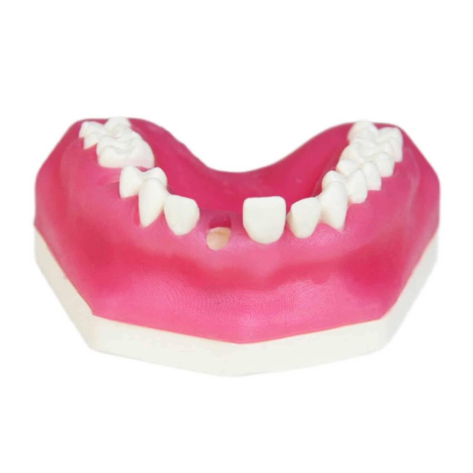 Zahnwurzelkanal Pratice Modell Zähne Wurzel Apex Läsion Modell Verbundharz Faserkern Restaurierungsmodell mit Basis für Vorderzähne