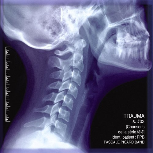 Trauma TV Serie 3 [Soundtrack]