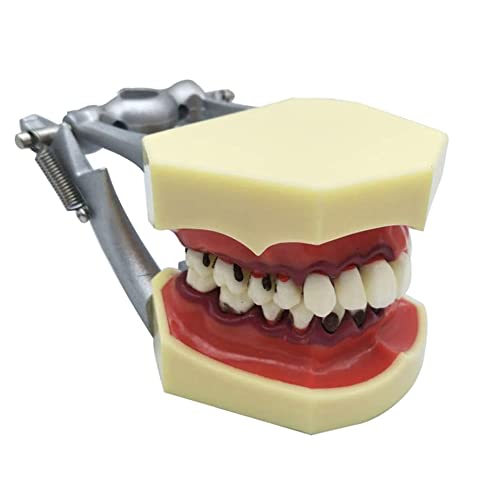 FHUILI Dental Teeth Studie Lehre Modell - Parodontose ASSORT Zähne Gums Zahnpflege Lehre Studienmodell - Simulation Oral Zahn Typodont Zähne Modell - für das Studium Lehr Anzeige,A