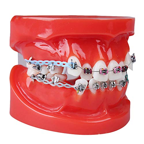 LUCKFY Dental Adult Typodont Demonstration Zähne Modell mit Mental Brackets KFO Zähne Modell mit Ligatur Krawatten Red