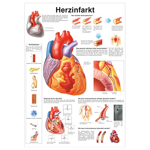 Herzinfarkt Poster Anatomie 70x50 cm medizinische Lehrmittel