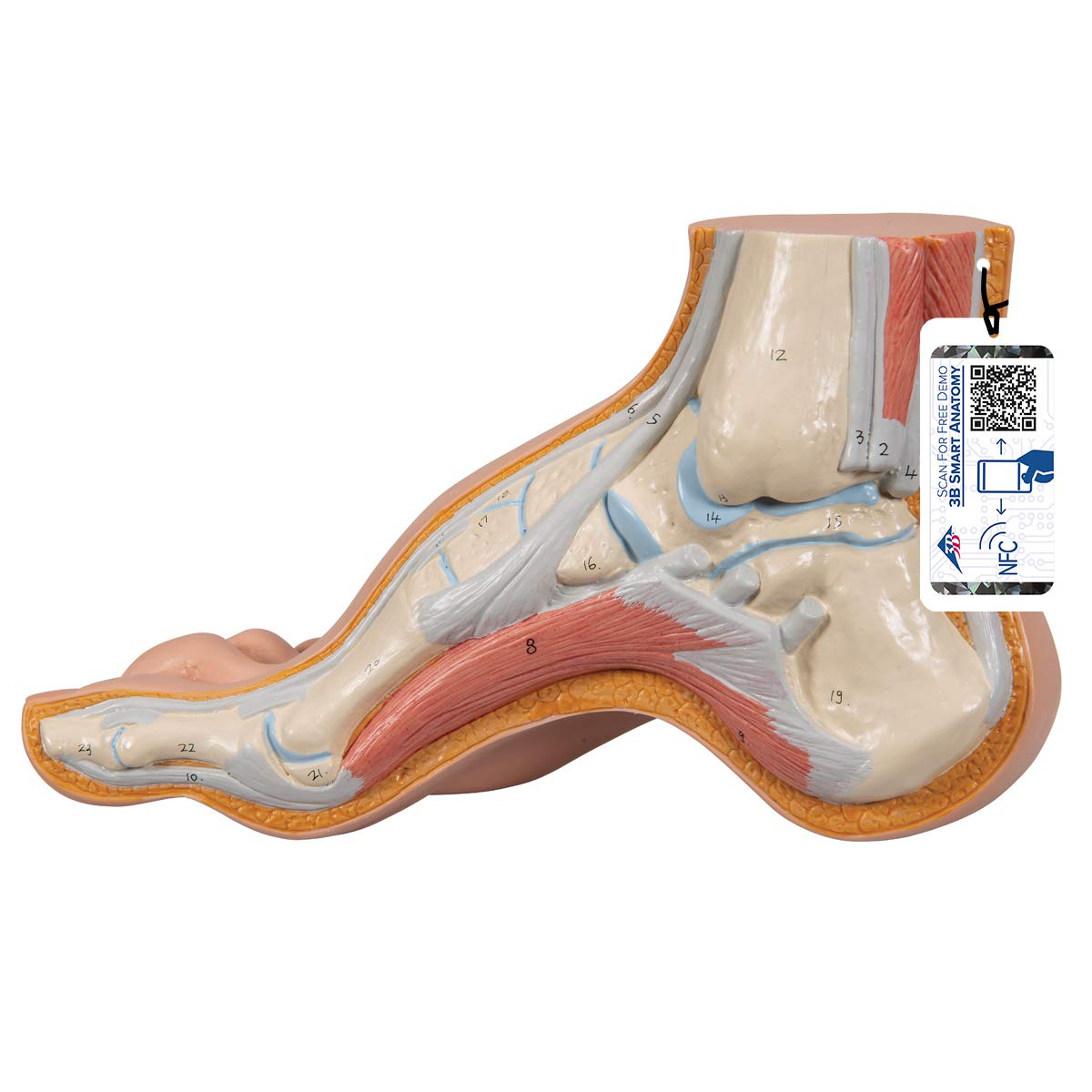 3B Scientific Menschliche Anatomie - Modell - Hohlfuß (Pes cavus) + kostenlose Anatomie App - 3B Smart Anatomy, M32