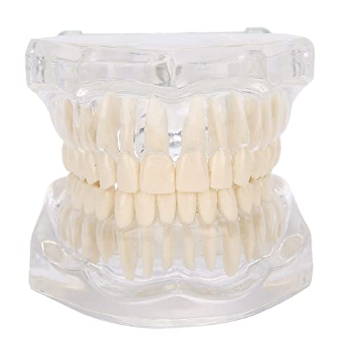 Study Teaching Teeth Model, Dental Model für Dental Schools Programme, Transparentes Acrylzähnen-Modell Simulation Zahn Zahn Modell für Lehr Demonstrationen