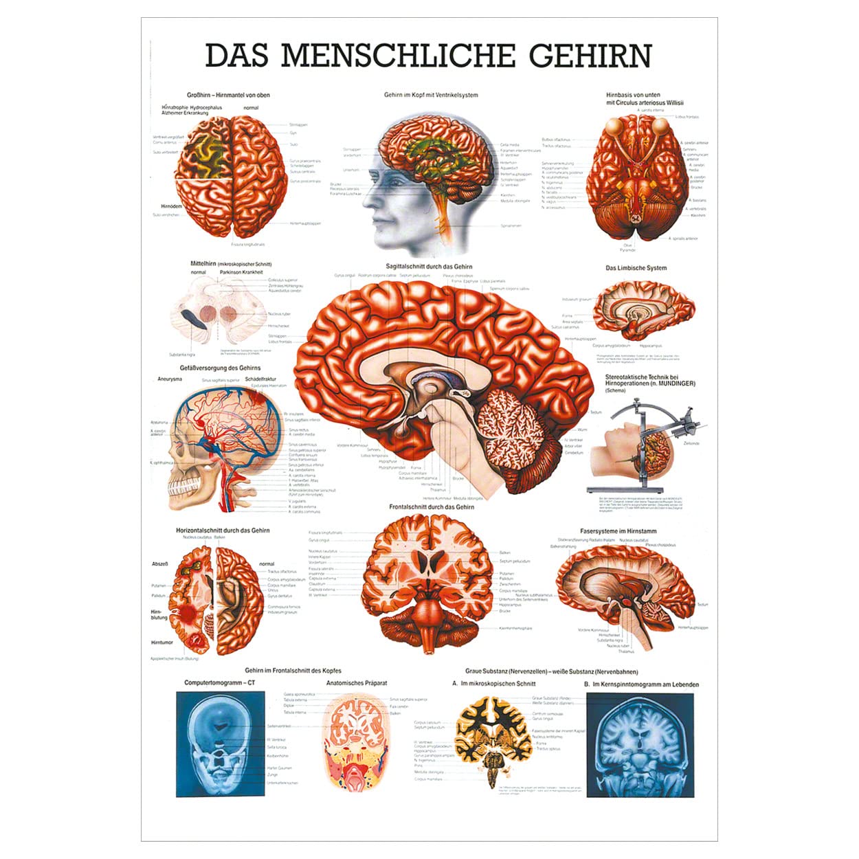 Rüdiger Das gehirn Lehrtafel Anatomie 100x70 cm medizinische Lehrmittel
