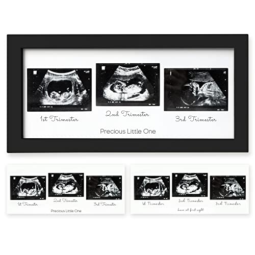 Trio Baby Bilderrahmen für Ultraschallbilder - Bilderrahmen Ultraschallbild Baby, Ultraschall Bilderrahmen Schwangerschaft, Ultraschallbilder Rahmen, Geschenke für Werdende Mamas (Onyx Black)