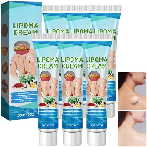 Lumpfree Lipoma Removal Cream, Lipoma Treatment, Herbal Extracts Moisturizing Body Cream, Effectively Relieve Fat Knots (6 Stück)