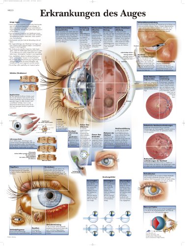 3B Scientific Lehrtafel laminiert - Erkrankungen des Auges