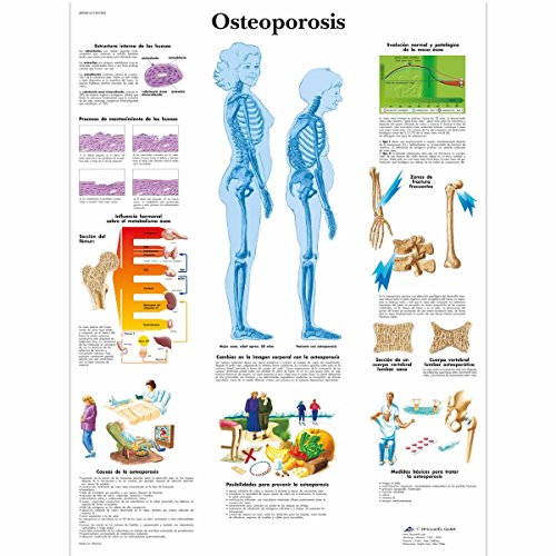 3B Scientific Papier bedruckt, Osteoporose, 1