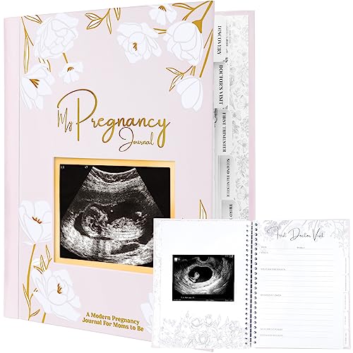 Schwangerschaftstagebuch, Schwangerschaftsankündigungen – 80 Seiten Hardcover Schwangerschaftsbuch für werdende Mutter – Schwangerschaftsgeschenke für neue Mütter – Geschenk zum ersten Mal erwartete