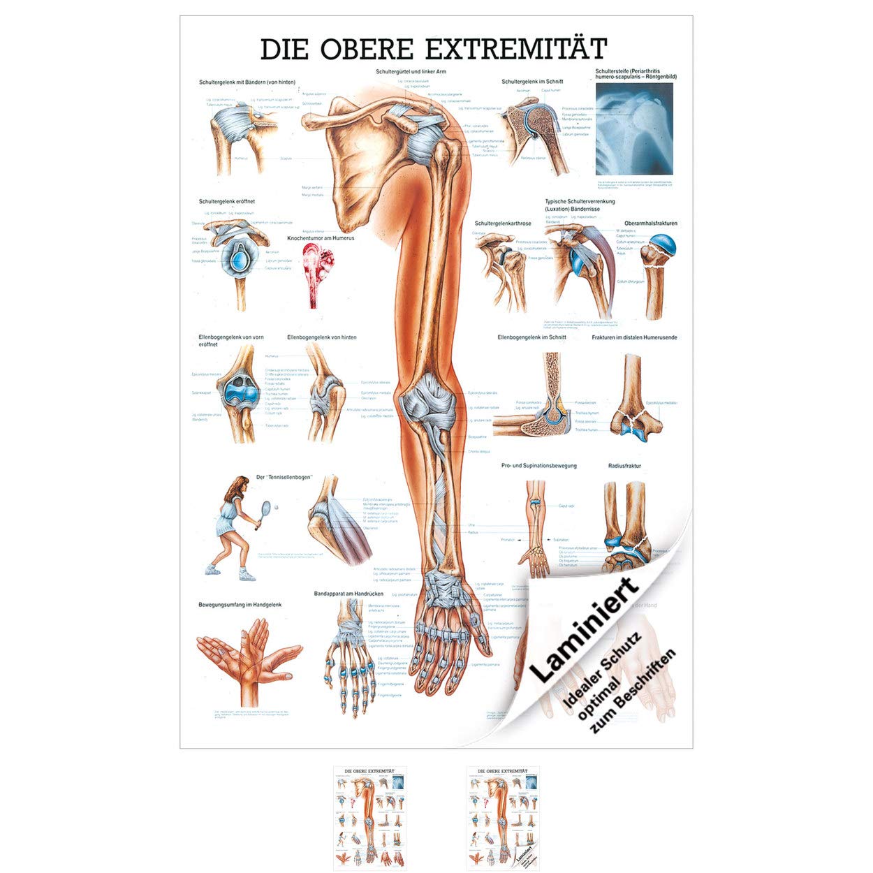 Rüdiger Obere Extremität Lehrtafel Anatomie 100x70 cm medizinische Lehrmittel