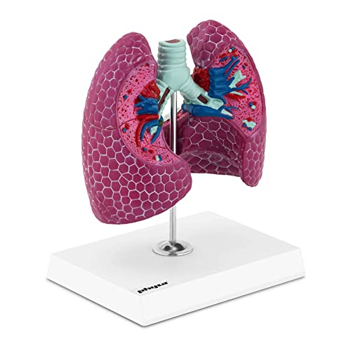 physa PHY-LM-1 Lungenmodell 1:1 Organmodell menschliche Lunge anatomisches Modell von Krebs befallen