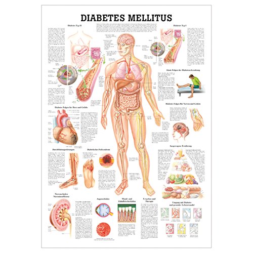 Sport-Tec Lehrtafel Diabetes Mellitus, LxB 100x70 cm