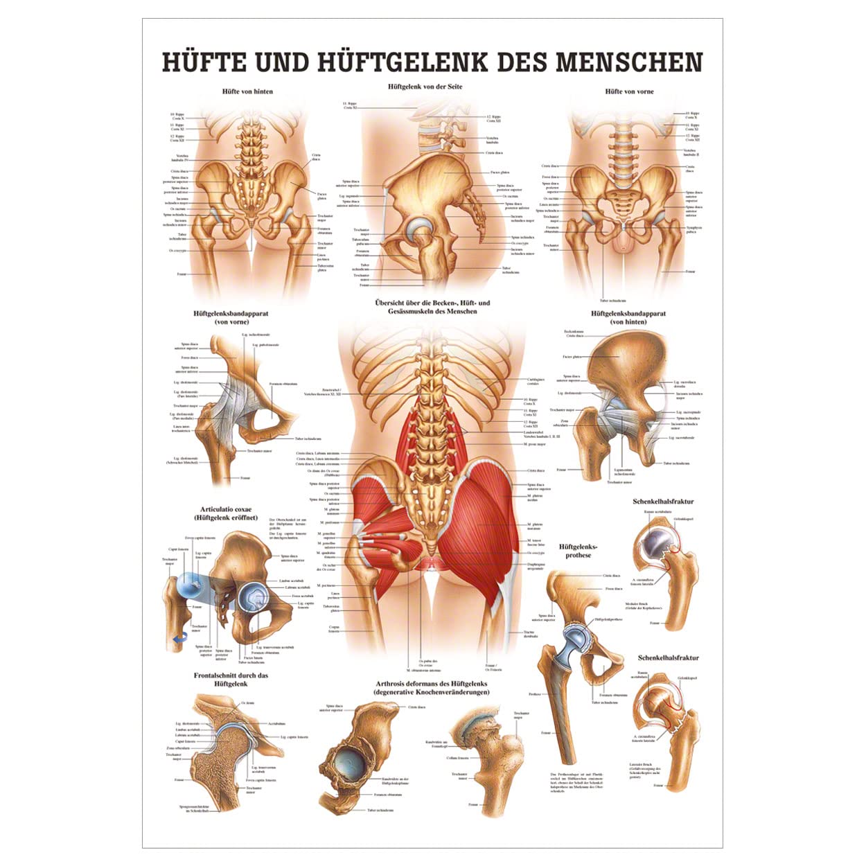 Rüdiger Hüfte und Hüftgelenk Lehrtafel Anatomie 100x70 cm medizinische Lehrmittel